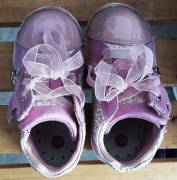 scarpe per bambina