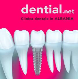 Dentisti a Tirana in Albania