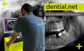 Clinica dentale a Durazzo in Albania con partenze da tutti gli aeroporti italiani