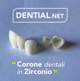 Corone dentali e faccette estetiche con i dentisti in Albania