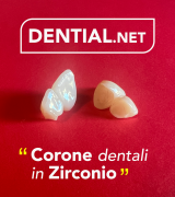 Corone dentali e faccette estetiche con i dentisti in Albania