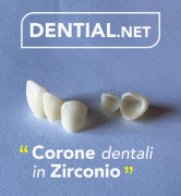 Corone dentali e faccette estetiche con i dentisti in Albania