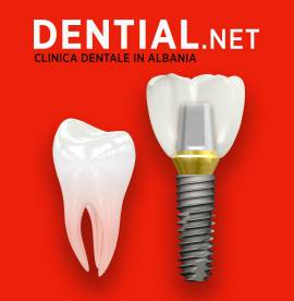 Dentisti in Albania - Risparmia il 60% con Dential clinica odontoiatrica
