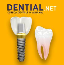 Dentisti in Albania - Risparmia il 60% con Dential clinica odontoiatrica