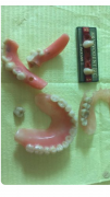 Odontotecnici Bologna Laboratorio Dentistico Riparazioni Protesi Dentali1ora 