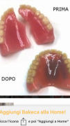 Odontotecnici Bologna Laboratorio Dentistico Riparazioni Protesi Dentali1ora 