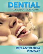 Dentisti in Albania - Clinica DENTIAL a Durazzo