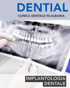 Dentisti in Albania - Clinica DENTIAL a Durazzo