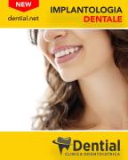 Dentisti in Albania - Clinica DENTIAL a Durazzo