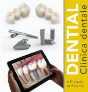 Come scegliere la migliore clinica dentale Albania