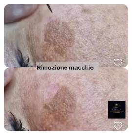 Estetica • Dermopigmentazione • Extension Ciglia • Pressoterapia • Plasma Pen