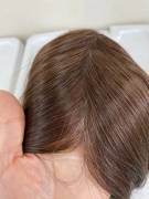 Protesi capelli per alopecia avanzata donna