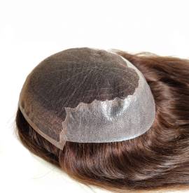 Protesi capelli per alopecia avanzata donna