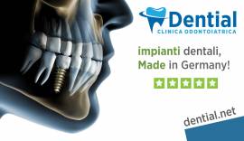 Impianti dentali in Albania o in Croazia scegliere in base alle recensioni