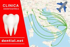 Impianti dentali in Albania o in Croazia scegliere in base alle recensioni