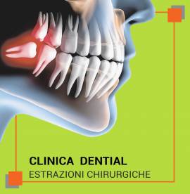 Come scegliere un dentista in Albania a Tirana o a Durazzo