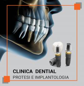 Come scegliere un dentista in Albania a Tirana o a Durazzo