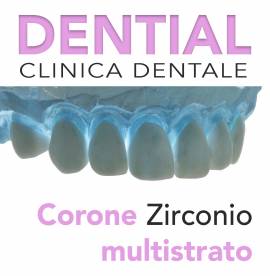 Dentisti in Albania - Risparmia il 50% con Dential clinica odontoiatrica