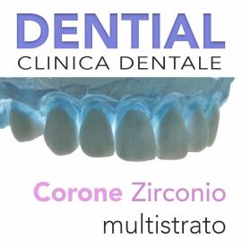 Dentisti in Albania - Risparmia il 50% con Dential clinica odontoiatrica