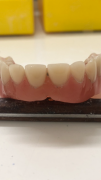 Laboratorio Odontotecnico Riparazioni Protesi Dentali urgenti Aperto Festivi Anche Domicilio Bologna