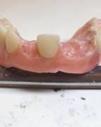 Laboratorio Dentistico Riparazioni Protesi Dentali urgenti Aperto Festivi Anche Domicilio Bologna