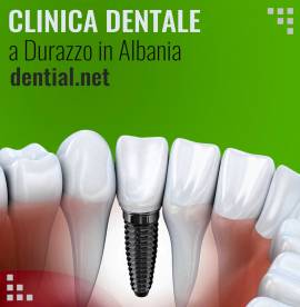 Prezzi dentisti in Albania clinica dentale a Durazzo