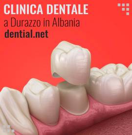 Prezzi dentisti in Albania clinica dentale a Durazzo