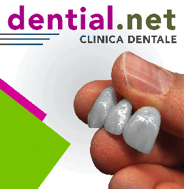 Dentisti in Albania, la vera alternativa alle cure dentali in Italia