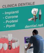 Quanto costa sistemare i denti in Albania?