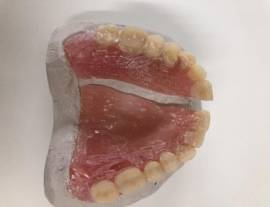 Odontotecnico Riparazioni Protesi Dentali Urgenti Bologna Festivi Domicilio