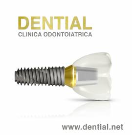 Quanto costa andare dal dentista in Albania?