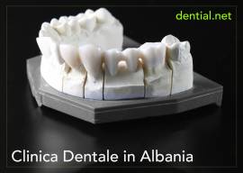 Quanto costa andare dal dentista in Albania?