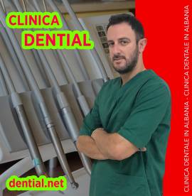 Quanto costa andare dal dentista in Albania?