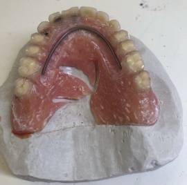 Laboratorio Protesi Dentarie Riparazioni Demtale1ora Festivi Domicilio Bologna,