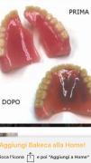 Laboratorio Protesi Dentarie Riparazioni dentiera 1ora Festivi Domicilio Bologna,