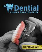 Clinica dentale in Albania, cure dentistiche e dentisti a Durazzo o Tirana