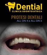 Clinica dentale in Albania, cure dentistiche e dentisti a Durazzo o Tirana