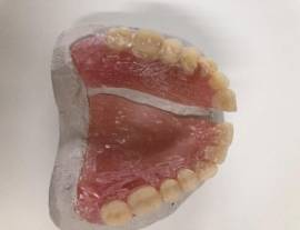 Odontotecnici Saldatura Riparazione1ora Protesi Dentale Laboratori Dentistici Bologna Festivi Domic.