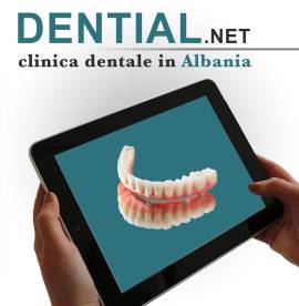 Da Bari a Durazzo in Albania per il dentista 