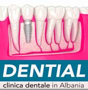 Da Bari a Durazzo in Albania per il dentista 