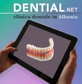 Da Bari a Durazzo in Albania per il dentista 