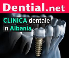 Quanto costa rifarsi i denti in Albania