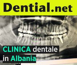 Quanto costa rifarsi i denti in Albania