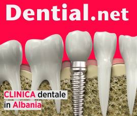 Quanto costa rifarsi i denti in Albania