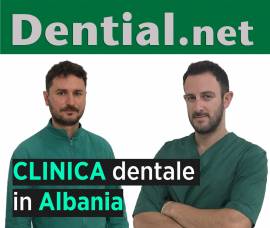 Quanto costa rifarsi i denti in Albania