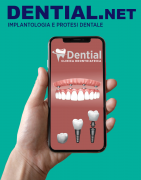 Prezzi impianti dentali in Albania