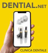 Prezzi impianti dentali in Albania