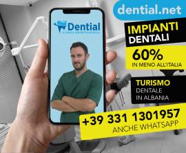 Prezzi impianti dentali in Albania